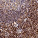BIN2 Antibody in Immunohistochemistry (IHC)