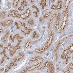 CCDC73 Polyclonal Antibody