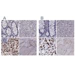 IKBIP Polyclonal Antibody