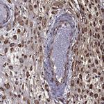 IKBIP Antibody in Immunohistochemistry (IHC)