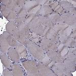 IKBIP Antibody in Immunohistochemistry (IHC)