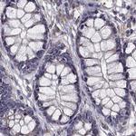 IKBIP Antibody in Immunohistochemistry (IHC)