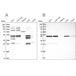 IKBIP Antibody in Western Blot (WB)