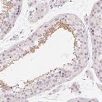 CAPZA3 Polyclonal Antibody