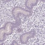 CAPZA3 Antibody in Immunohistochemistry (IHC)