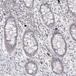 LY6G5C Antibody in Immunohistochemistry (Paraffin) (IHC (P))