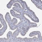 LY6G5C Antibody in Immunohistochemistry (Paraffin) (IHC (P))