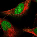 PSMD13 Polyclonal Antibody