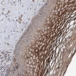 MSANTD2 Polyclonal Antibody