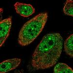 MSANTD2 Polyclonal Antibody