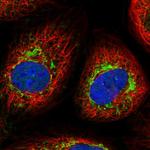 FGFR1OP2 Polyclonal Antibody