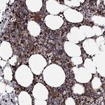 FGFR1OP2 Antibody in Immunohistochemistry (Paraffin) (IHC (P))