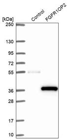 FGFR1OP2 Antibody in Western Blot (WB)