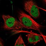 MON2 Polyclonal Antibody