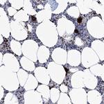 MON2 Antibody in Immunohistochemistry (IHC)