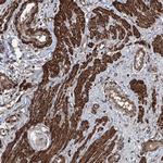 CCDC82 Antibody in Immunohistochemistry (Paraffin) (IHC (P))
