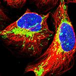 TRPT1 Polyclonal Antibody