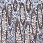 TRPT1 Antibody in Immunohistochemistry (Paraffin) (IHC (P))