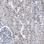 TRPT1 Antibody in Immunohistochemistry (Paraffin) (IHC (P))