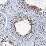 TRPT1 Antibody in Immunohistochemistry (Paraffin) (IHC (P))