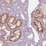 PRAP1 Antibody in Immunohistochemistry (Paraffin) (IHC (P))