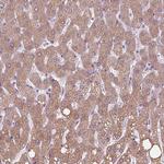 PRAP1 Antibody in Immunohistochemistry (Paraffin) (IHC (P))