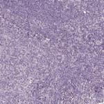 PRAP1 Antibody in Immunohistochemistry (Paraffin) (IHC (P))