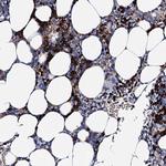 ATG2A Antibody in Immunohistochemistry (Paraffin) (IHC (P))