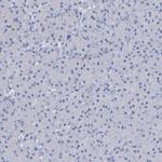 ATG2A Polyclonal Antibody