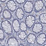 ATG2A Antibody in Immunohistochemistry (Paraffin) (IHC (P))