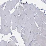 ATG2A Antibody in Immunohistochemistry (Paraffin) (IHC (P))