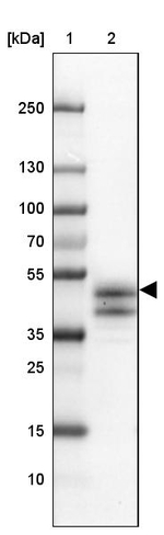 Acrosomal Vesicle Protein Antibody in Western Blot (WB)