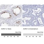 Acrosomal Vesicle Protein Antibody in Immunohistochemistry (IHC)
