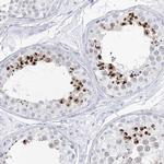 Acrosomal Vesicle Protein Antibody in Immunohistochemistry (IHC)