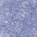 Acrosomal Vesicle Protein Antibody in Immunohistochemistry (IHC)
