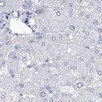 Acrosomal Vesicle Protein Antibody in Immunohistochemistry (IHC)