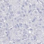 Acrosomal Vesicle Protein Antibody in Immunohistochemistry (IHC)