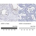Acrosomal Vesicle Protein Antibody