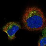 RBP5 Polyclonal Antibody