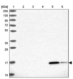 RBP5 Antibody in Western Blot (WB)