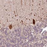 ALKBH8 Antibody in Immunohistochemistry (Paraffin) (IHC (P))