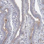 ALKBH8 Antibody in Immunohistochemistry (Paraffin) (IHC (P))