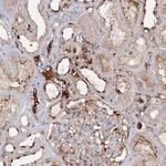 ALKBH8 Antibody in Immunohistochemistry (Paraffin) (IHC (P))