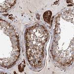 LRRC56 Polyclonal Antibody