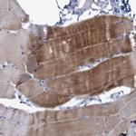 NEU3 Polyclonal Antibody