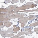 NEU3 Polyclonal Antibody