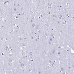 TTC36 Antibody in Immunohistochemistry (Paraffin) (IHC (P))