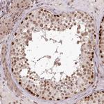 THYN1 Antibody in Immunohistochemistry (IHC)