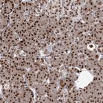 THYN1 Antibody in Immunohistochemistry (Paraffin) (IHC (P))