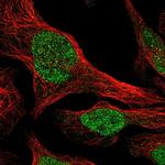 AP3B1 Polyclonal Antibody